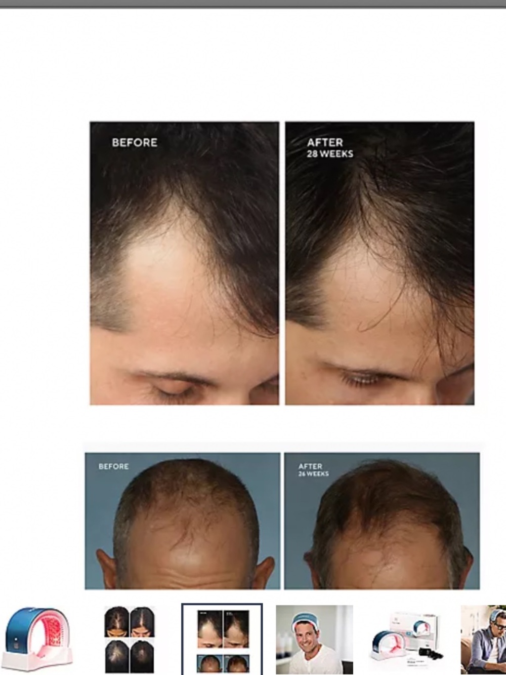 Hairmax Laser Band 41 - Picture 2 of 6